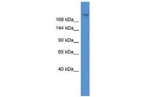 Western Blot showing TPR antibody used at a concentration of 1 ug/ml against 721_B Cell Lysate (TPR antibody  (C-Term))