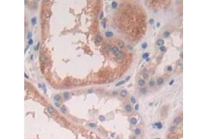 Used in DAB staining on fromalin fixed paraffin- embedded Kidney tissue (SRI antibody  (AA 29-169))