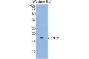 Western Blotting (WB) image for anti-Sema Domain, Immunoglobulin Domain (Ig), Transmembrane Domain (TM) and Short Cytoplasmic Domain, (Semaphorin) 4D (SEMA4D) (AA 502-636) antibody (ABIN1860524) (SEMA4D/CD100 antibody  (AA 502-636))