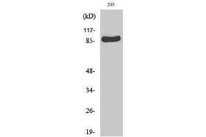 Western Blotting (WB) image for anti-Ribosomal Protein S6 Kinase, 90kDa, Polypeptide 1 (RPS6KA1) (Thr888) antibody (ABIN3186845) (RPS6KA1 antibody  (Thr888))