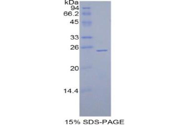 GPX5 Protein