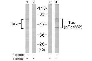 Image no. 1 for anti-Microtubule-Associated Protein tau (MAPT) (Ser262) antibody (ABIN197268) (MAPT antibody  (Ser262))