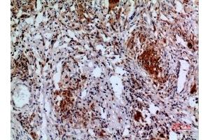 Immunohistochemical analysis of paraffin-embedded human-lung, antibody was diluted at 1:100. (APAF1 antibody  (Internal Region))