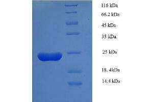 SDS-PAGE (SDS) image for Serum Amyloid A (SAA) (AA 1-90), (full length) protein (His tag,B2M) (ABIN5710306) (SAA Protein (AA 1-90, full length) (His tag,B2M))