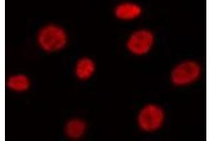 ABIN6275443 staining Hela by IF/ICC. (RANBP17 antibody  (N-Term))