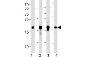 Western blot analysis of lysate from human (2) HepG2, (2) NCCIT and mouse (3) NIH3T3, (4) F9 cell lines using Hmga2 antibody at 1:1000. (HMGA2 antibody  (C-Term))