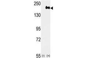 Western blot analysis of anti-HER2 antibody and 293 cell lysate (2 ug/lane) either nontransfected (Lane 1) or transiently transfected with the ERBB2 gene (2). (ErbB2/Her2 antibody  (AA 1227-1255))