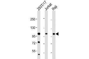 Western Blot at 1:2000 dilution Lane 1: 293T/17 whole cell lysate Lane 2: Jurkat whole cell lysate Lane 3: Raji whole cell lysate Lysates/proteins at 20 ug per lane. (REST antibody  (AA 542-570))