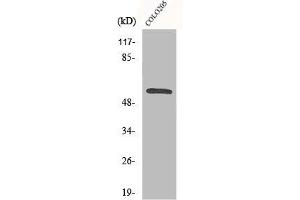 Western Blot analysis of Jurkat cells using CaMKIIβ/γ Polyclonal Antibody (CAMK2B antibody  (C-Term))