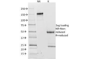 SDS-PAGE Analysis Purified CD62L Mouse Monoclonal Antibody (CD62L/1588). (L-Selectin antibody)