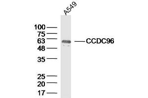 Lane 1: A549 lysates probed with CCDC96 Polyclonal Antibody, Unconjugated  at 1:300 overnight at 4˚C. (CCDC96 antibody  (AA 301-400))