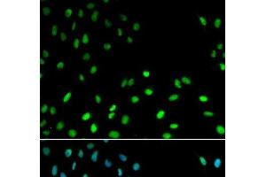 Immunofluorescence analysis of MCF-7 cells using RFC1 Polyclonal Antibody (RFC1 antibody)