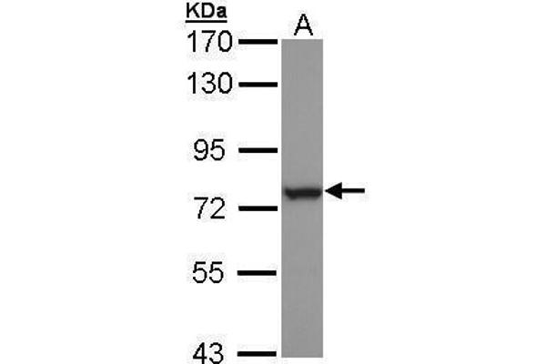 HSPA6 antibody  (Center)