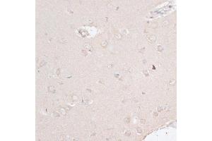 Immunohistochemistry of paraffin-embedded rat brain using ABCF2 antibody. (ABCF2 antibody)