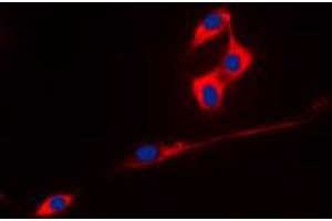 Immunofluorescent analysis of ECHOS1 staining in A431 cells. (TMPRSS3 antibody  (C-Term))