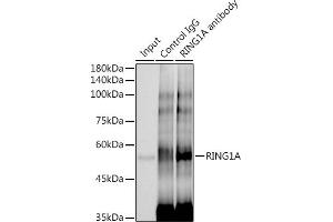 Immunoprecipitation analysis of 300 μg extracts of HeLa cells using 3 μg RING1A antibody (ABIN7270051). (RING1 antibody)