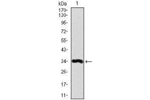 Western blot analysis using LPA mAb against human LPA recombinant protein. (Lp(a) antibody  (AA 1823-2013))