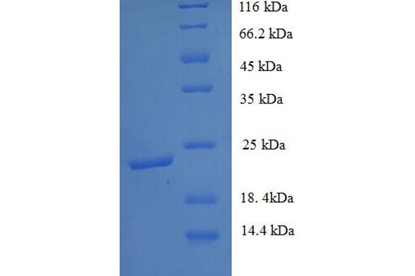 Ephrin B3 Protein (EFNB3) (AA 28-227) (His tag)