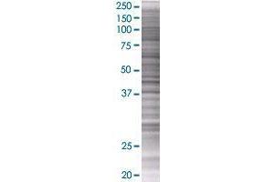 TRY1 transfected lysate. (TRY1 293T Cell Transient Overexpression Lysate(Denatured))