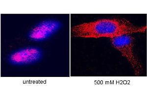 Anti-hTERT Antibody - Immunofluorescence Microscopy  anti hTERT antibody-Immunofluorescence# anti hTERT antibody was used to stain hTERT on hTERT-over-expressing fibroblasts. (hTERT (C-Term) antibody)