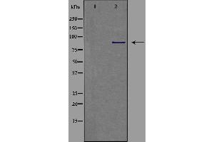 Western blot analysis of extracts from COLO cells, using CDH9 antibody. (Cadherin 9 antibody  (Internal Region))