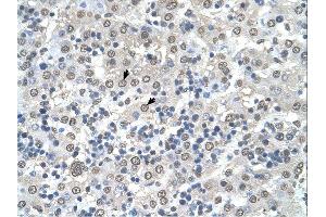 CDR2 antibody was used for immunohistochemistry at a concentration of 4-8 ug/ml. (CDR2 antibody  (N-Term))