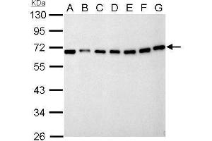 WB Image Nucleoporin p62 antibody detects NUP62 protein by Western blot analysis. (NUP62 antibody)