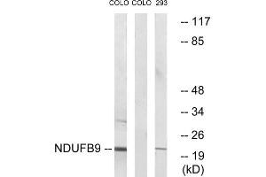 Western blot analysis of extracts from COLO cells and 293 cells, using NDUFB9 antibody. (NDUFB9 antibody  (Internal Region))