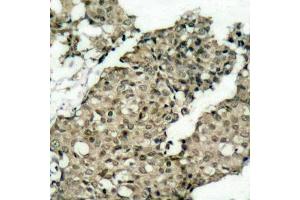 Immunohistochemistry (IHC) image for anti-GTPase Activating Protein (SH3 Domain) Binding Protein 1 (G3BP1) (pSer232) antibody (ABIN3020220) (G3BP1 antibody  (pSer232))