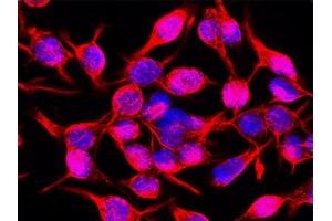 Immunofluorescence (IF) image for anti-Vimentin (VIM) antibody (ABIN94492)