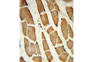 Forlin-fixed and paraffin-embedded hun skeletal muscle reacted with SD4 Antibody (C-term), which was peroxidase-conjugated to the secondary antibody, followed by DAB staining. (SMAD4 antibody  (C-Term))