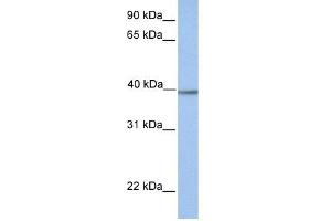 AMT antibody used at 1 ug/ml to detect target protein. (Aminomethyltransferase antibody  (N-Term))