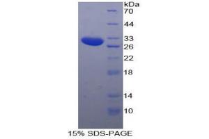 SDS-PAGE analysis of Human SSFA2 Protein. (SSFA2 Protein)