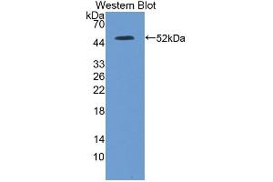 Figure. (ITPA antibody  (AA 2-198))