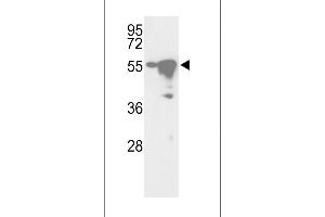 Western blot analysis of hYSK- (ABIN392471 and ABIN2842055) in Ramos and HepG2 cell line lysates (35 μg/lane). (YSK (AA 325-356), (C-Term) antibody)