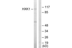 Western Blotting (WB) image for anti-Hexokinase 1 (HK1) (N-Term) antibody (ABIN1849224) (Hexokinase 1 antibody  (N-Term))