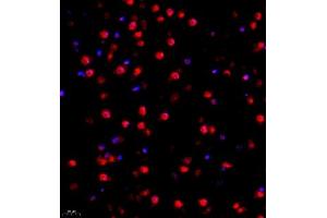 Immunofluorescence of paraffin embedded mouse brain using FUS (ABIN7075919) at dilution of 1:1000 (400x lens) (TLS/FUS antibody)