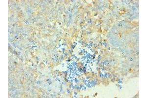 Immunohistochemistry of paraffin-embedded human tonsil tissue using ABIN7143440 at dilution of 1:100 (CD38 antibody  (AA 75-300))