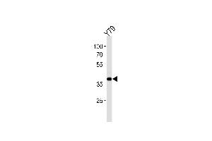 Western blot analysis in Y79 cell line lysates (35ug/lane). (SIX3 antibody  (AA 138-166))