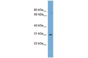 WB Suggested Anti-C1orf183 Antibody Titration: 0. (FAM212B antibody  (Middle Region))