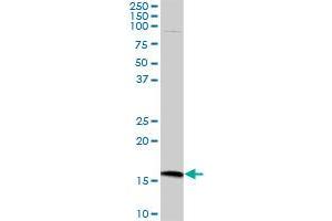 CMTM5 MaxPab polyclonal antibody. (CMTM5 antibody  (AA 1-156))