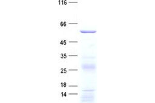 Sec8 Protein (His tag)