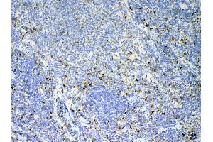 IHC analysis of IL17 using anti-IL17 antibody . (Interleukin 17a antibody  (AA 26-158))