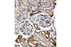 Anti-WISP1 antibody, IHC(P) IHC(P): Rat Kidney Tissue (WISP1 antibody  (C-Term))