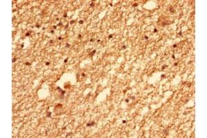 Immunohistochemistry of paraffin-embedded human brain tissue using ABIN7147383 at dilution of 1:100 (CEP126 antibody  (AA 559-670))