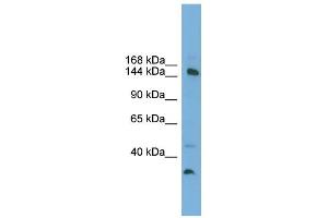 WB Suggested Anti-MED14 Antibody Titration: 0. (MED14 antibody  (Middle Region))