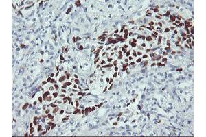 Immunohistochemistry (IHC) image for anti-Tumor Protein P53 (TP53) antibody (ABIN1499978) (p53 antibody)