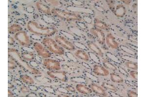 IHC-P analysis of Human Kidney Tissue, with DAB staining. (GAL3ST1 antibody  (AA 57-196))