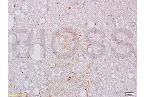 Formalin-fixed and paraffin embedded human brain tissue labeled with Anti-GPIIb Polyclonal Antibody, Unconjugated (ABIN748358) at 1:200 followed by conjugation to the secondary antibody, (SP-0023), and DAB staining (Integrin Alpha2b antibody  (AA 351-450))