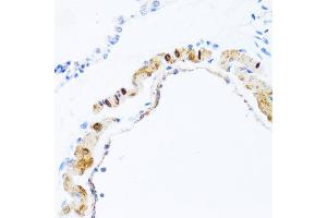 Immunohistochemistry of paraffin-embedded rat lung using PHPT1 antibody. (PHPT1 antibody)